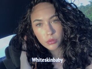 Whiteskinbaby